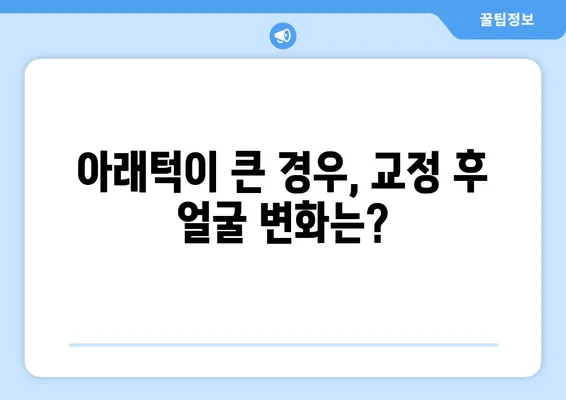 삼성역 교정 치과| 위턱보다 아래턱이 큰 치아 교정, 어떻게 해야 할까요? | 돌출입, 부정교합, 아래턱 전진, 치아 교정, 삼성역 치과