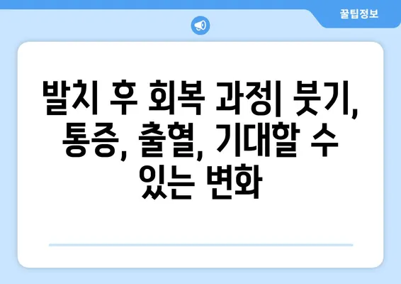 치아 발치 후 예후| 좋은 결과를 위한 기대와 관리 | 발치 후 회복, 통증 관리, 주의사항