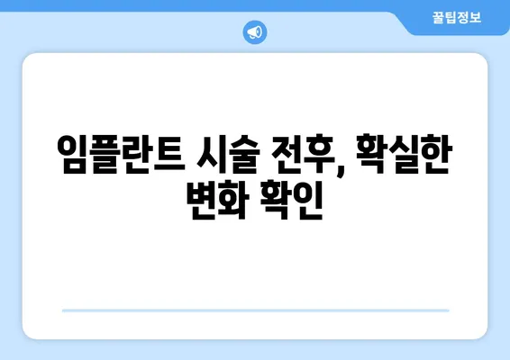 인천 임플란트 시술 전후| 나에게 맞는 치아 상황은? | 임플란트 상담, 치아 건강, 인천 치과