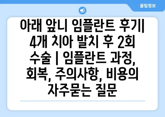 아래 앞니 임플란트 후기| 4개 치아 발치 후 2회 수술 | 임플란트 과정, 회복, 주의사항, 비용